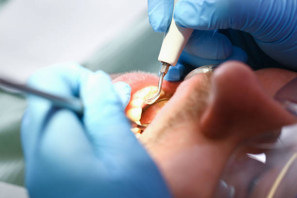 Best Emergency Dental Surgery in Crescent, OK