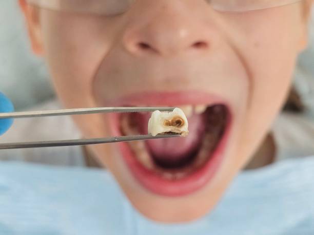 Best Emergency Treatment for Toothache in Crescent, OK
